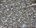 ACSBG1 Antibody in Immunohistochemistry (Paraffin) (IHC (P))