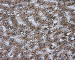 ACSBG1 Antibody in Immunohistochemistry (Paraffin) (IHC (P))