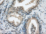 ACSBG1 Antibody in Immunohistochemistry (Paraffin) (IHC (P))