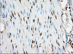 ACSBG1 Antibody in Immunohistochemistry (Paraffin) (IHC (P))