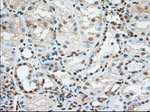 ACSBG1 Antibody in Immunohistochemistry (Paraffin) (IHC (P))