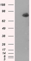 ACSBG1 Antibody in Western Blot (WB)