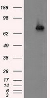 ACSBG1 Antibody in Western Blot (WB)