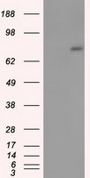 ACSBG1 Antibody in Western Blot (WB)