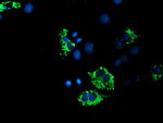 ACSF2 Antibody in Immunocytochemistry (ICC/IF)