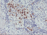 ACSF2 Antibody in Immunohistochemistry (Paraffin) (IHC (P))