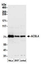 ACSL4/FACL4 Antibody in Western Blot (WB)