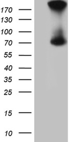 ACSL5 Antibody in Western Blot (WB)