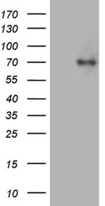 ACSL5 Antibody in Western Blot (WB)