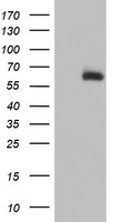 ACSM5 Antibody in Western Blot (WB)