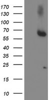 ACSM5 Antibody in Western Blot (WB)