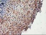 ACSS2 Antibody in Immunohistochemistry (Paraffin) (IHC (P))