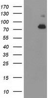 ACSS2 Antibody in Western Blot (WB)