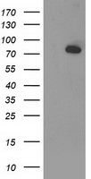 ACSS2 Antibody in Western Blot (WB)