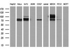 ACSS2 Antibody in Western Blot (WB)