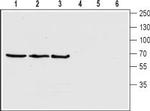 Choline Transporter (SLC5A7) (extracellular) Antibody in Western Blot (WB)