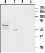 SLC22A1 Antibody in Western Blot (WB)