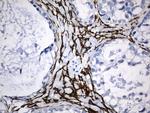 ACTA2 (smooth muscle actin alpha, SMA) Antibody in Immunohistochemistry (Paraffin) (IHC (P))