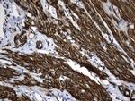 ACTA2 (smooth muscle actin alpha, SMA) Antibody in Immunohistochemistry (Paraffin) (IHC (P))