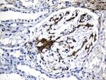 ACTA2 (smooth muscle actin alpha, SMA) Antibody in Immunohistochemistry (Paraffin) (IHC (P))