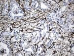 ACTA2 (smooth muscle actin alpha, SMA) Antibody in Immunohistochemistry (Paraffin) (IHC (P))