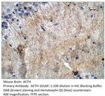 ACTH Antibody in Immunohistochemistry (Paraffin) (IHC (P))