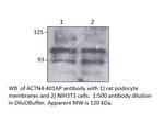 alpha Actinin 4 Antibody in Western Blot (WB)