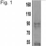 alpha Actinin 4 Antibody in Western Blot (WB)