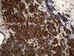 ACTR3 Antibody in Immunohistochemistry (Paraffin) (IHC (P))