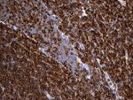 ACTR3 Antibody in Immunohistochemistry (Paraffin) (IHC (P))