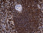 ACTR3 Antibody in Immunohistochemistry (Paraffin) (IHC (P))