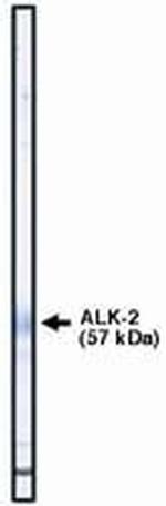 ACVR1 Antibody in Western Blot (WB)