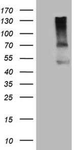 ACVR2A Antibody in Western Blot (WB)