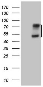 ACVR2A Antibody in Western Blot (WB)