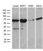 ACVRL1 Antibody in Western Blot (WB)