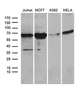 ACVRL1 Antibody in Western Blot (WB)