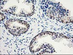 ACY1 Antibody in Immunohistochemistry (Paraffin) (IHC (P))