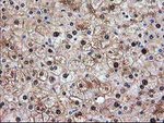 ACY1 Antibody in Immunohistochemistry (Paraffin) (IHC (P))