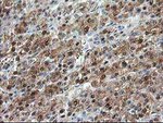 ACY1 Antibody in Immunohistochemistry (Paraffin) (IHC (P))