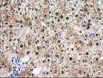 ACY1 Antibody in Immunohistochemistry (Paraffin) (IHC (P))