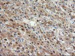 ACY1 Antibody in Immunohistochemistry (Paraffin) (IHC (P))