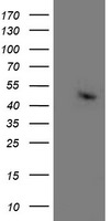 ACY1 Antibody in Western Blot (WB)