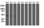 ACY1 Antibody in Western Blot (WB)