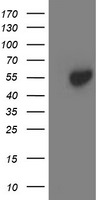 ACY1 Antibody in Western Blot (WB)