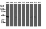 ACY1 Antibody in Western Blot (WB)