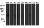 ACY1 Antibody in Western Blot (WB)