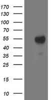 ACY1 Antibody in Western Blot (WB)