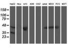 ACY1 Antibody in Western Blot (WB)