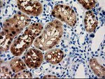 ACY3 Antibody in Immunohistochemistry (Paraffin) (IHC (P))