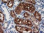 ACY3 Antibody in Immunohistochemistry (Paraffin) (IHC (P))